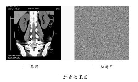 浅析基于多混沌系统的医学图像加密算法
